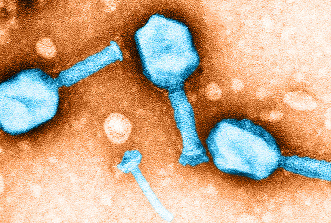 Enterobacteria phage T5 (TEM)