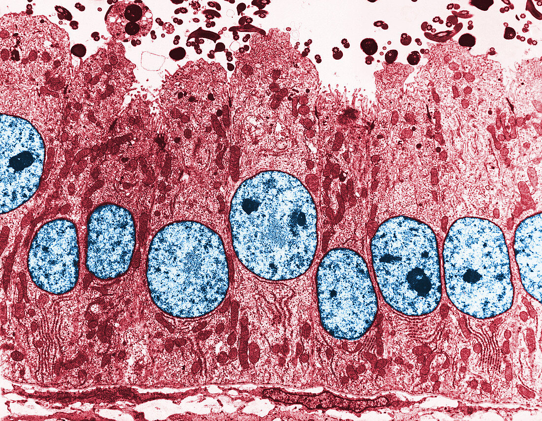 TEM of Vas Deferens