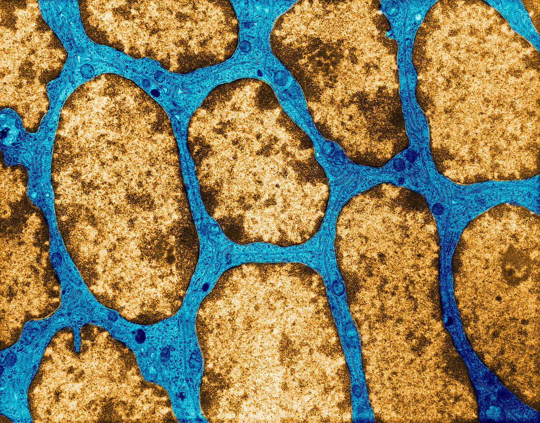 TEM of Epithelium of Human Epididymis