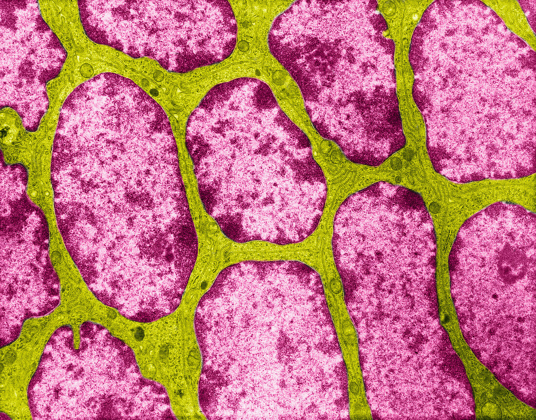 TEM of Epithelium of Human Epididymis