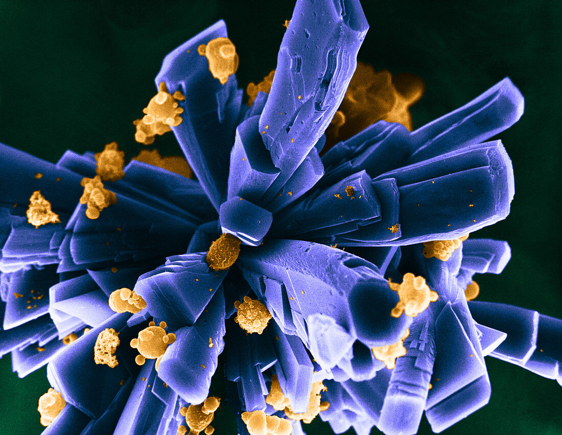 Human Cells Growing,SEM