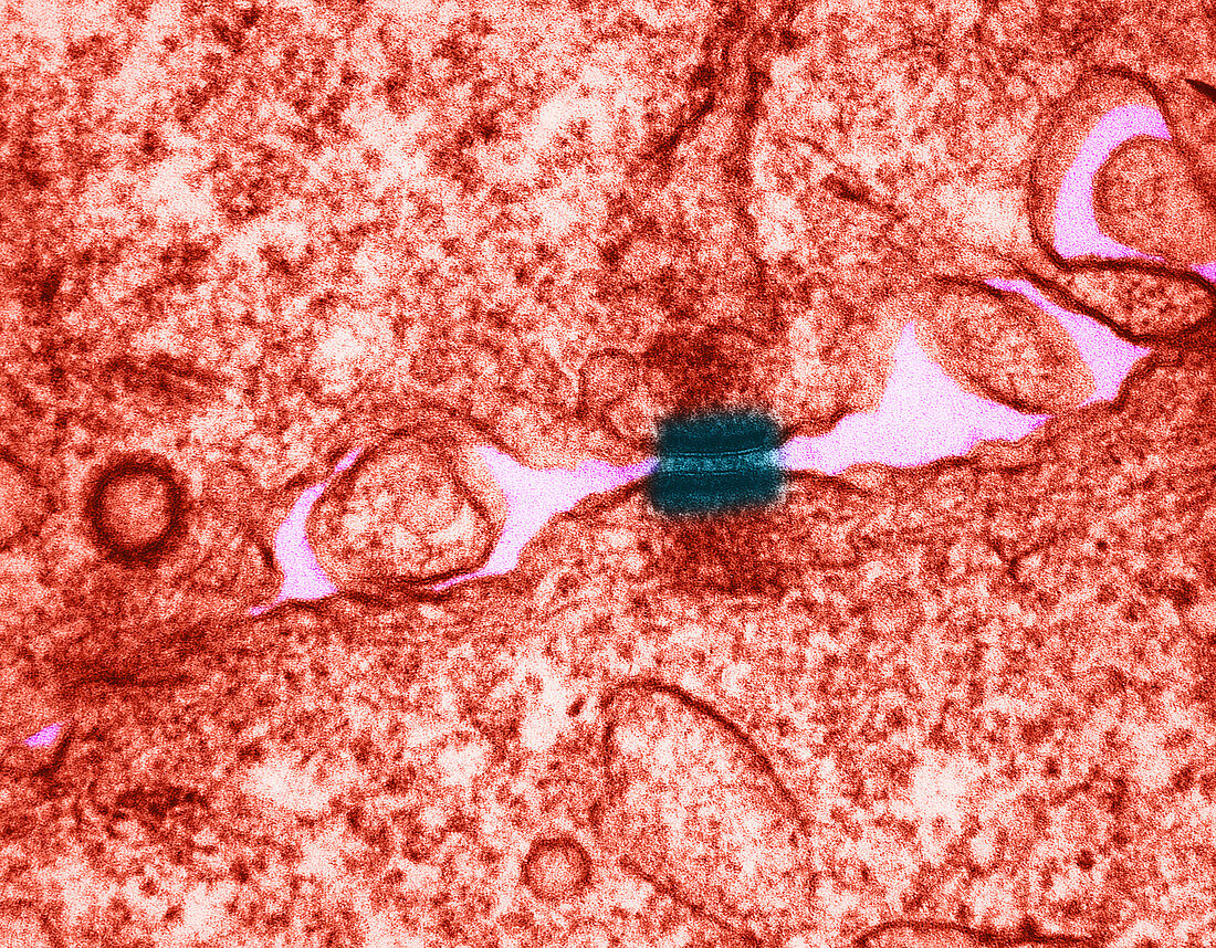 Desmosomes Between Epithelial Cells,TEM