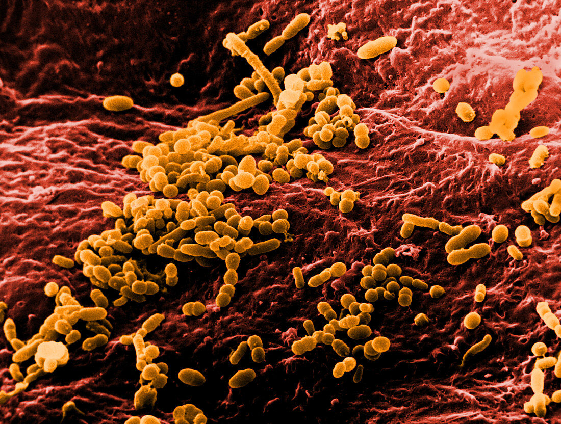 Skin Bacteria,SEM