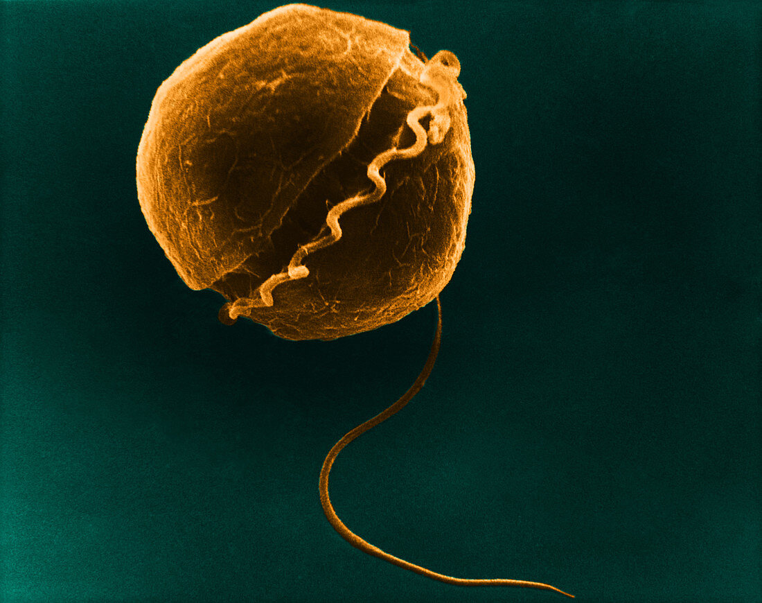 Dinoflagellate,SEM