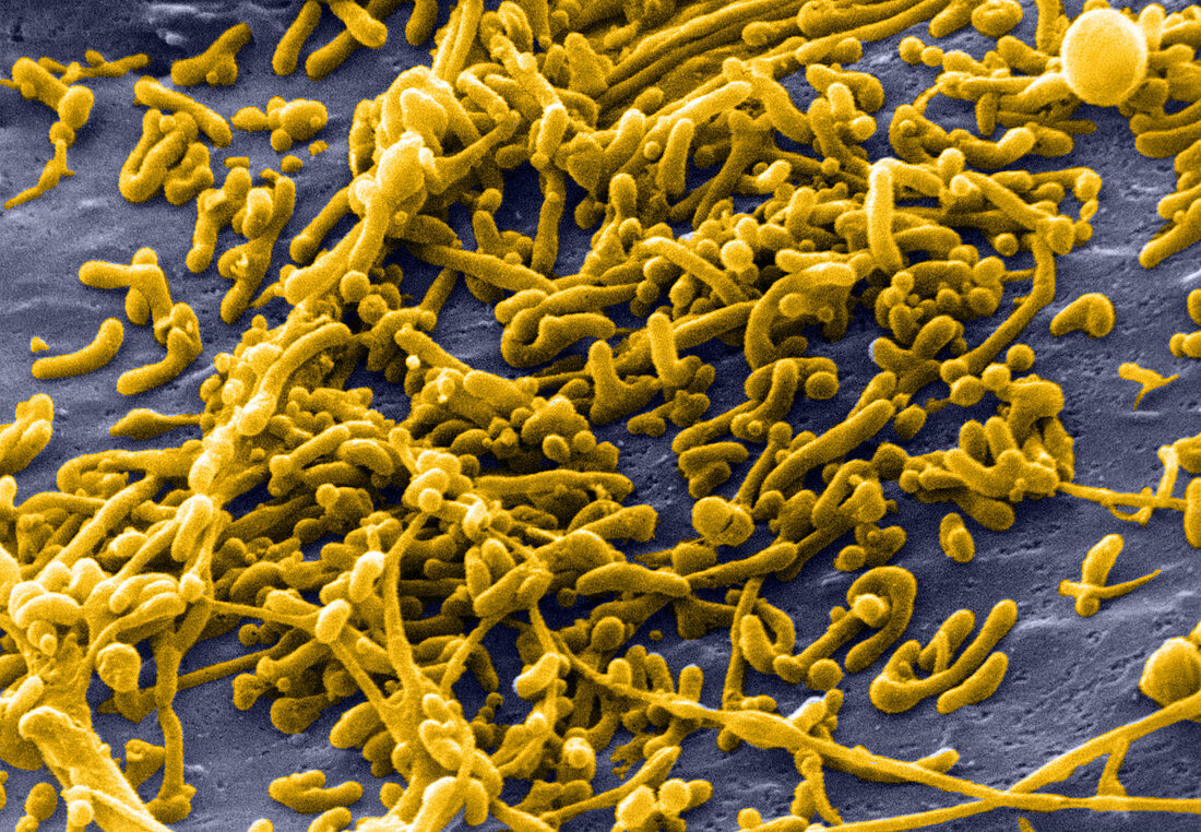 Mycoplasma Bacteria,SEM