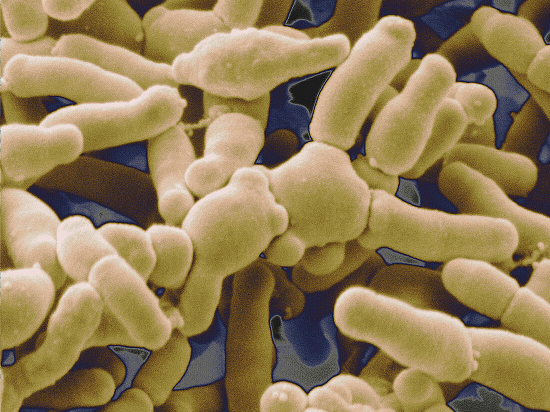 Bifidobacterium Breve Bacteria,SEM