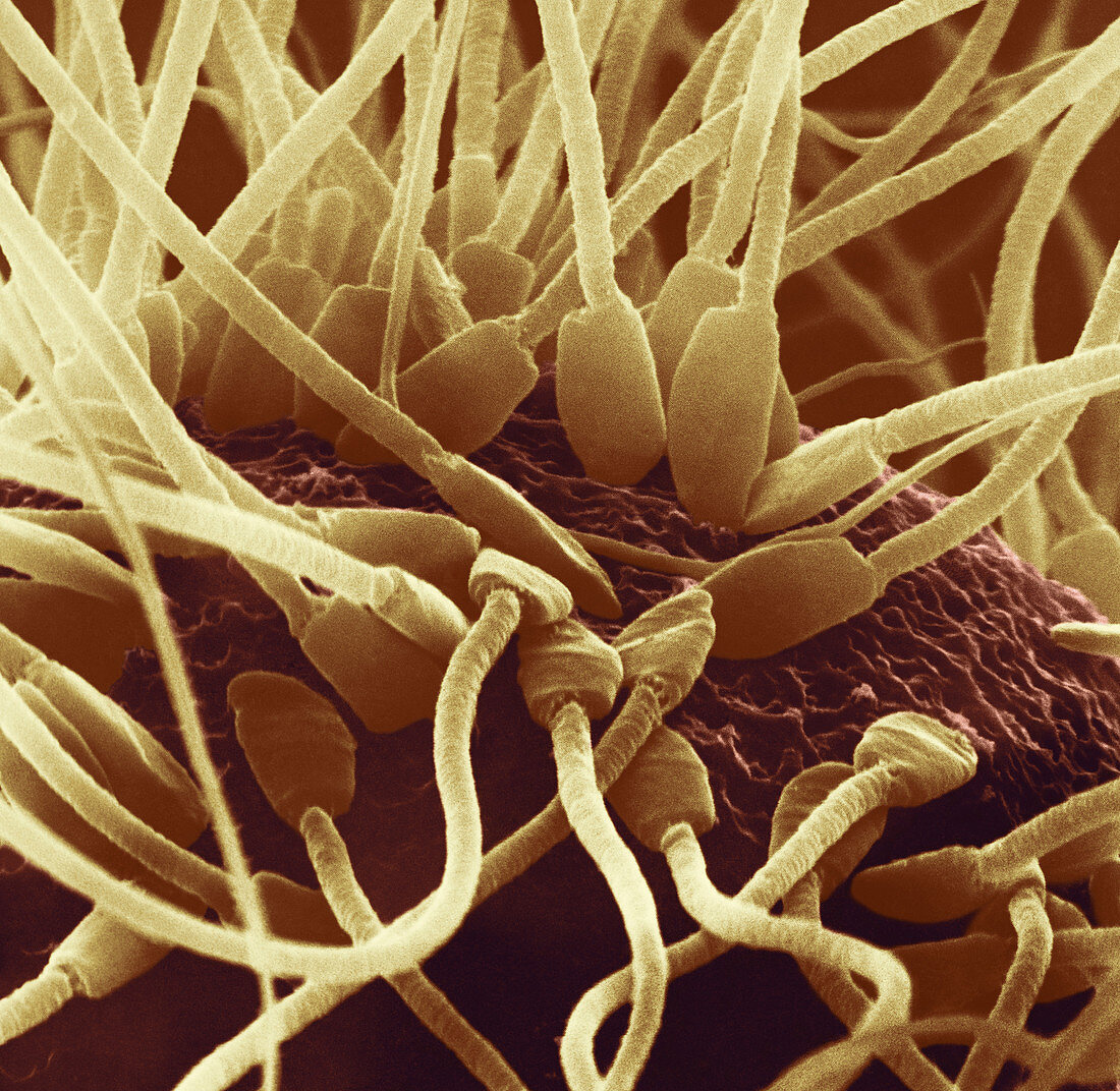 Fertilization in Rat (SEM)