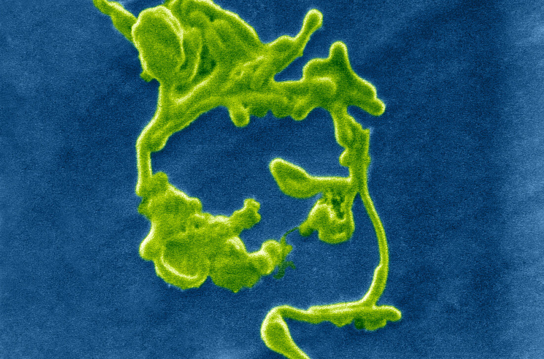 Ebola Virus (SEM)