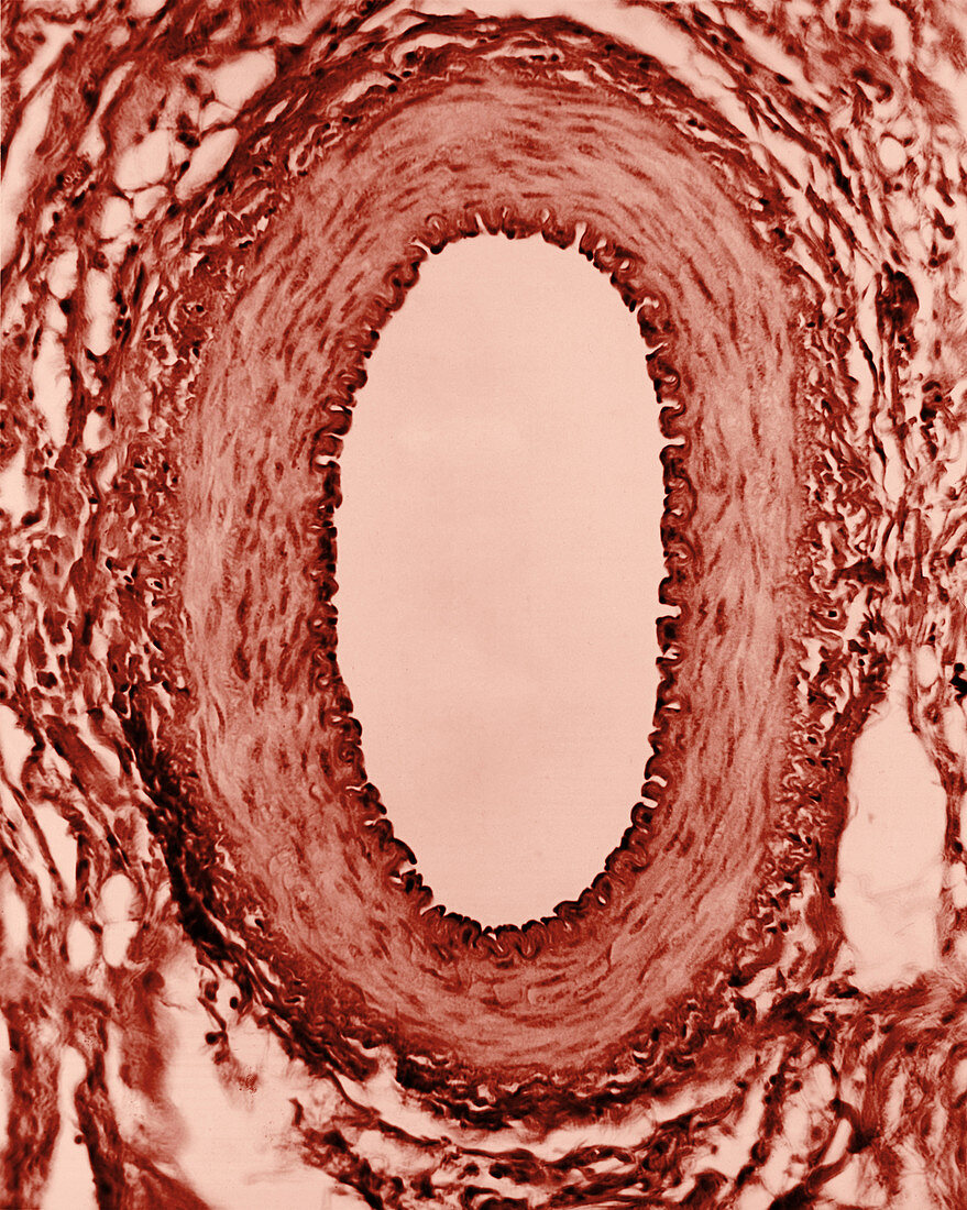 Normal Artery,TEM