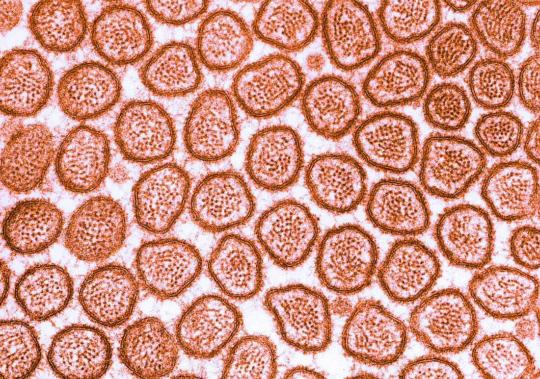 Microvilli in Intestinal Epithelium,TEM