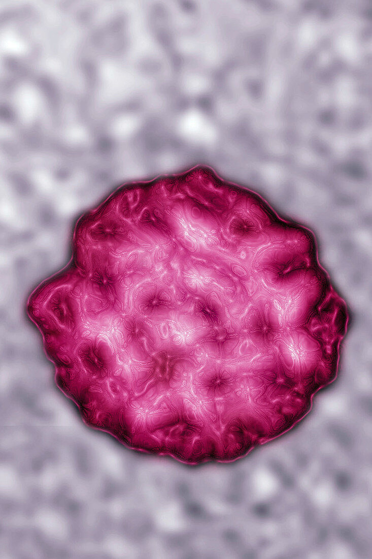 Norovirus,TEM