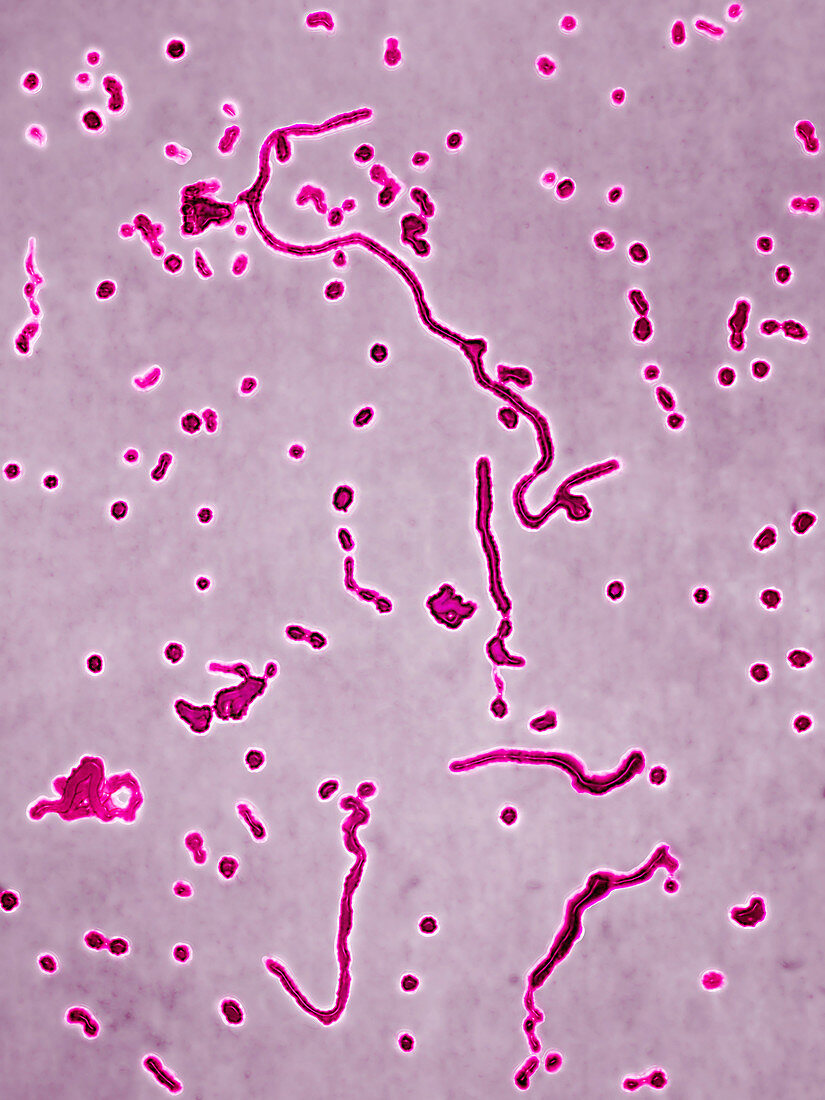 Haemophilus influenzae bacteria,LM