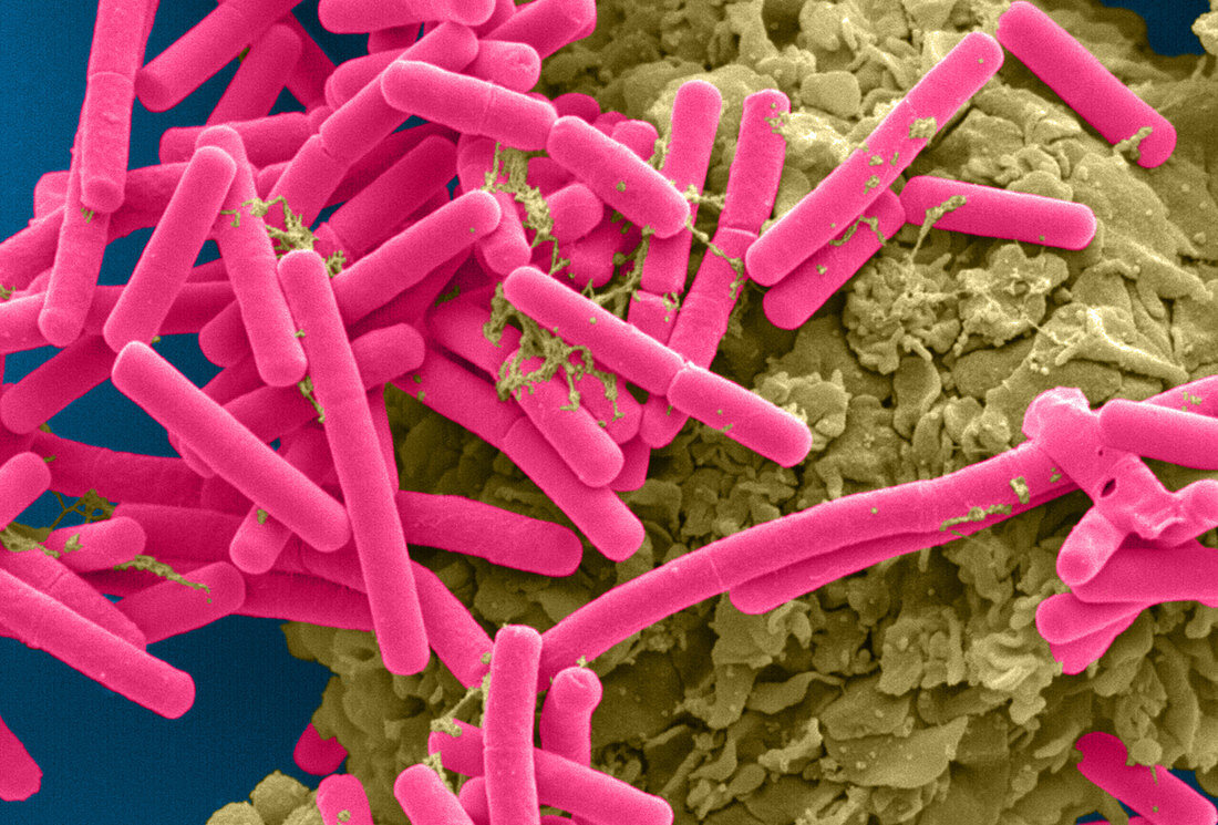 E. coli and Macrophage (SEM)