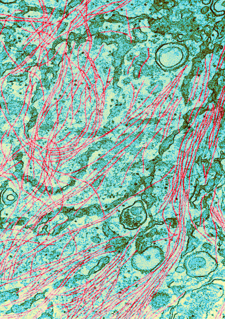 TEM of Cytoplasm of 3T3 Cell