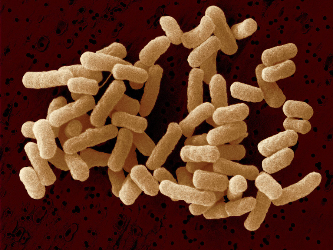 Escherichia coli O26