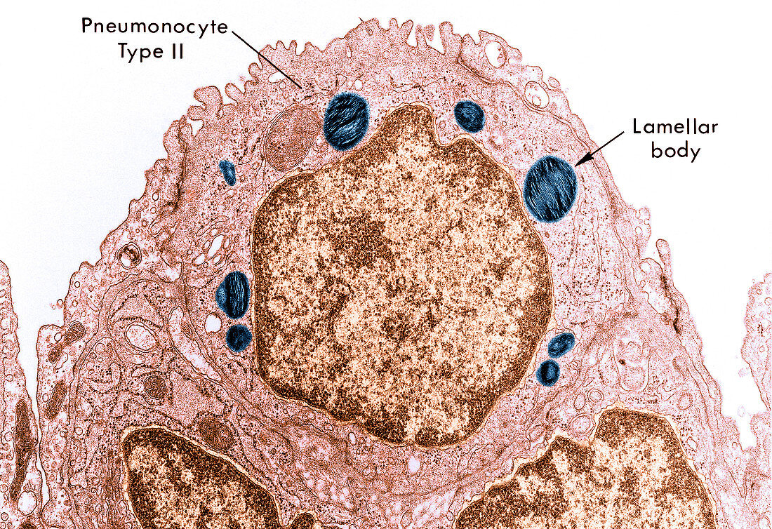 Alveolar cell,TEM