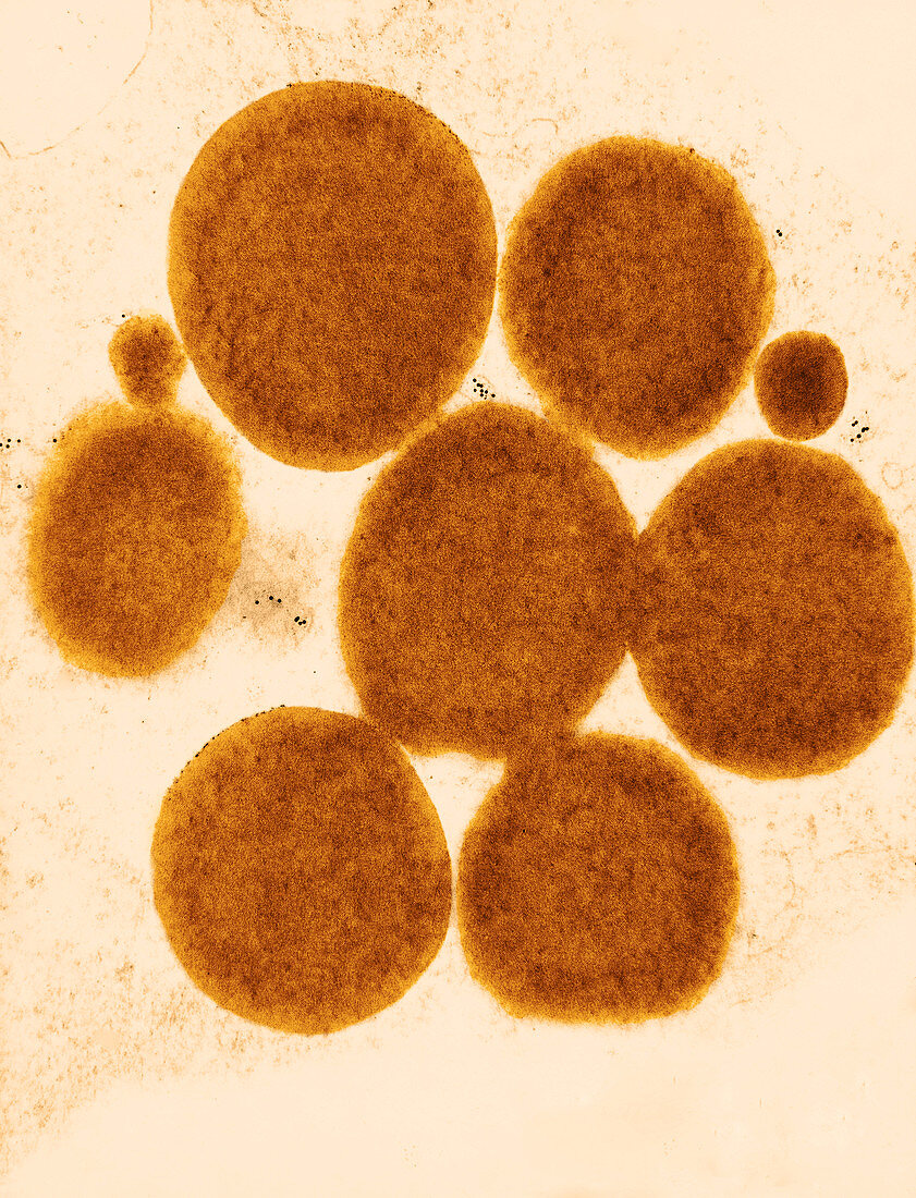 Lipid Droplets (TEM)
