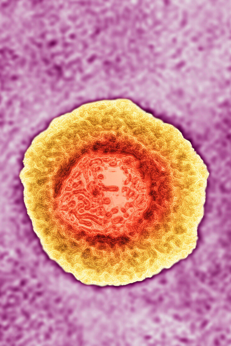 Varicella Zona Virus,TEM