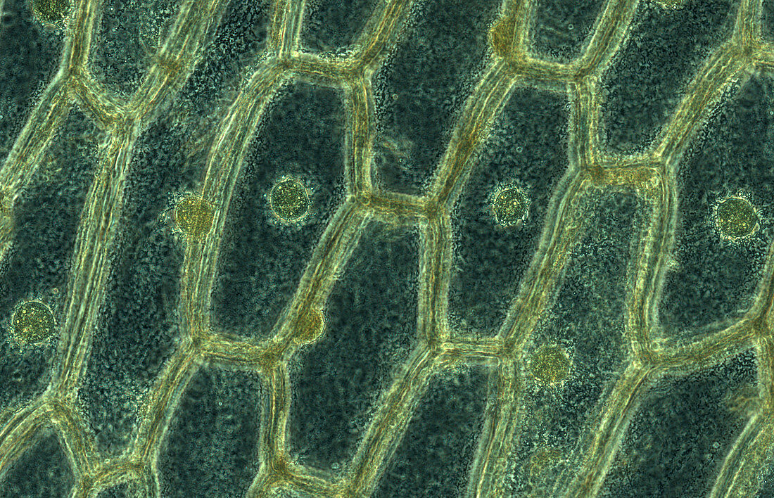 Iodine Stained Onion Cells