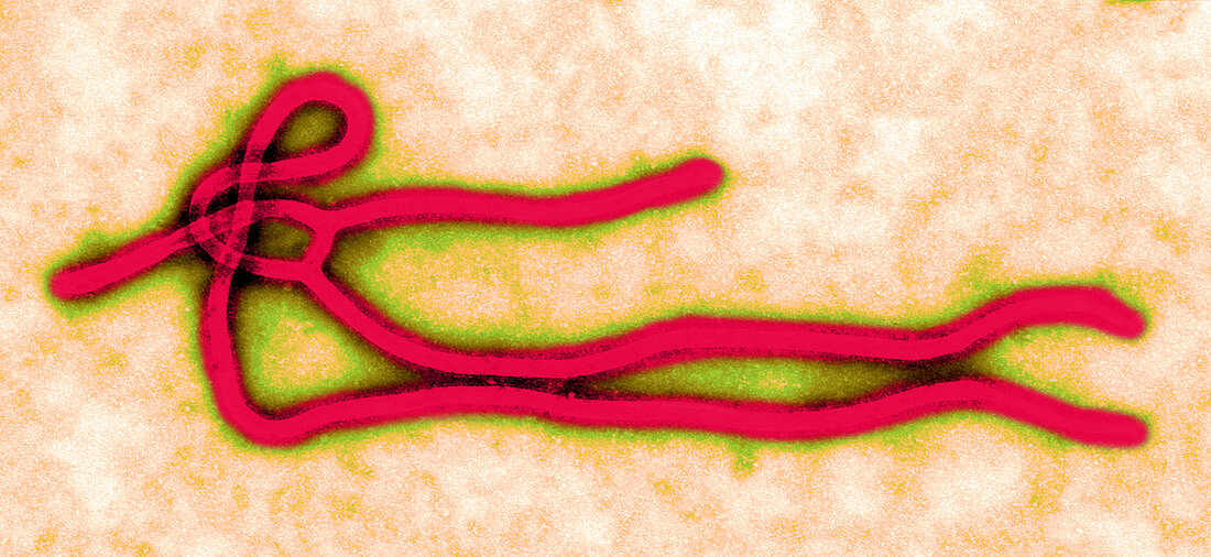 Ebola Virus,TEM