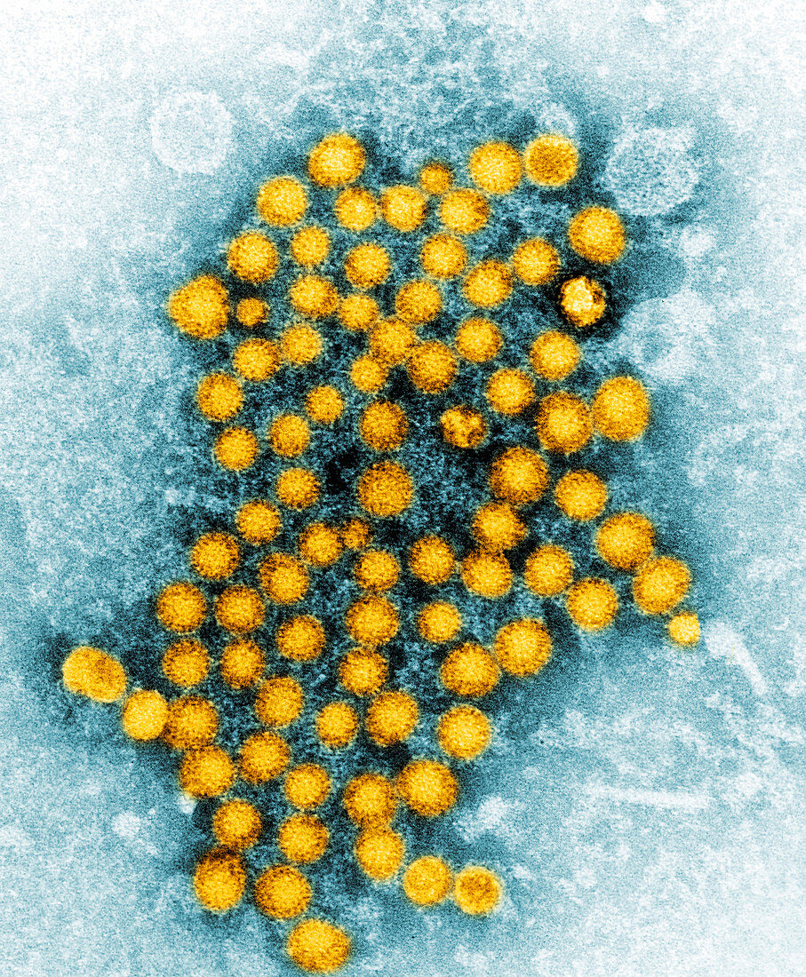 Hepatitis Virus,Unknown Strain,TEM