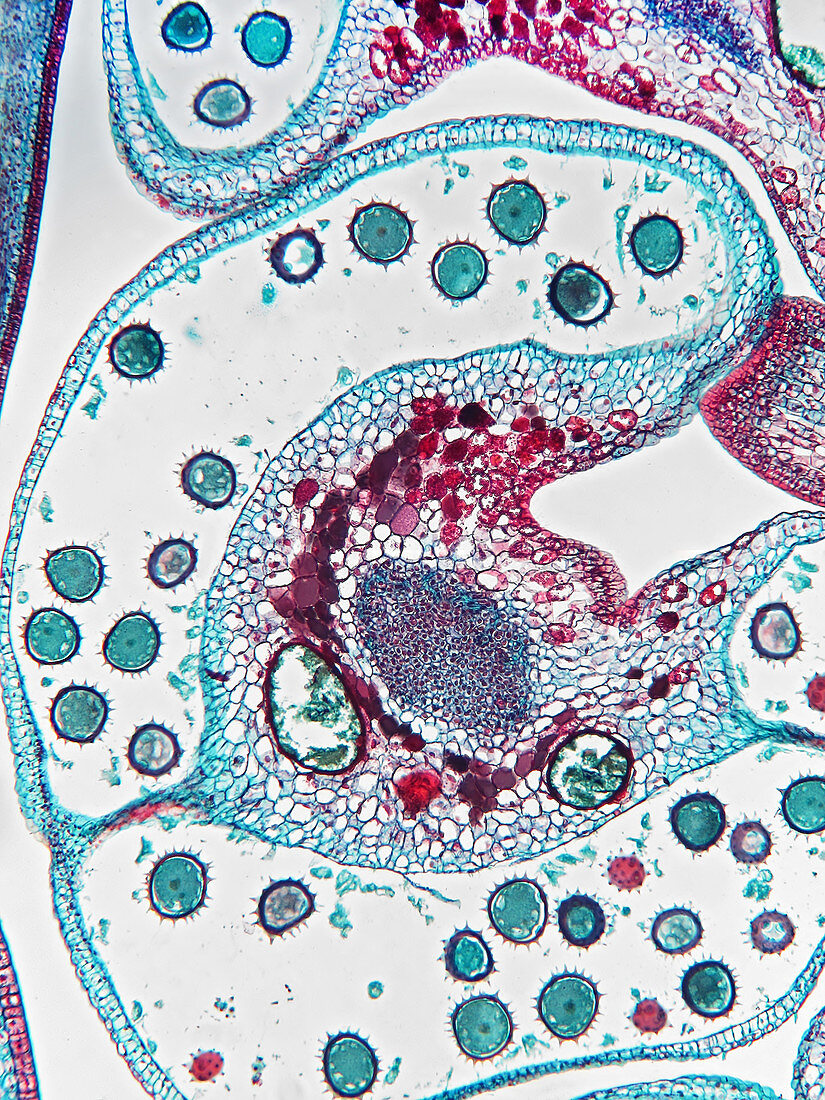 Pollen Packets in Cotton,Gossypium,LM