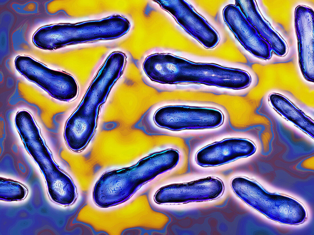 Clostridium Botulinum Bacteria,LM