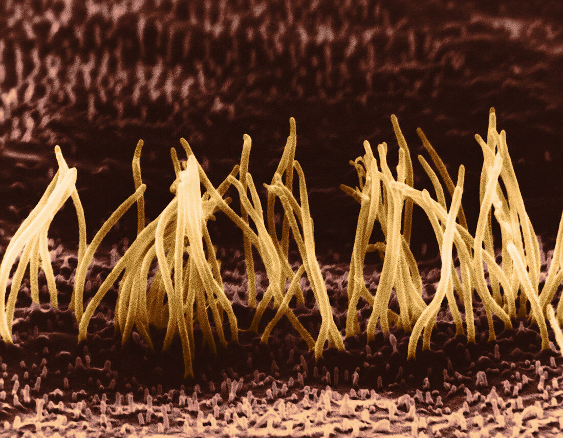 SEM of Cilia on Epithelial Cells