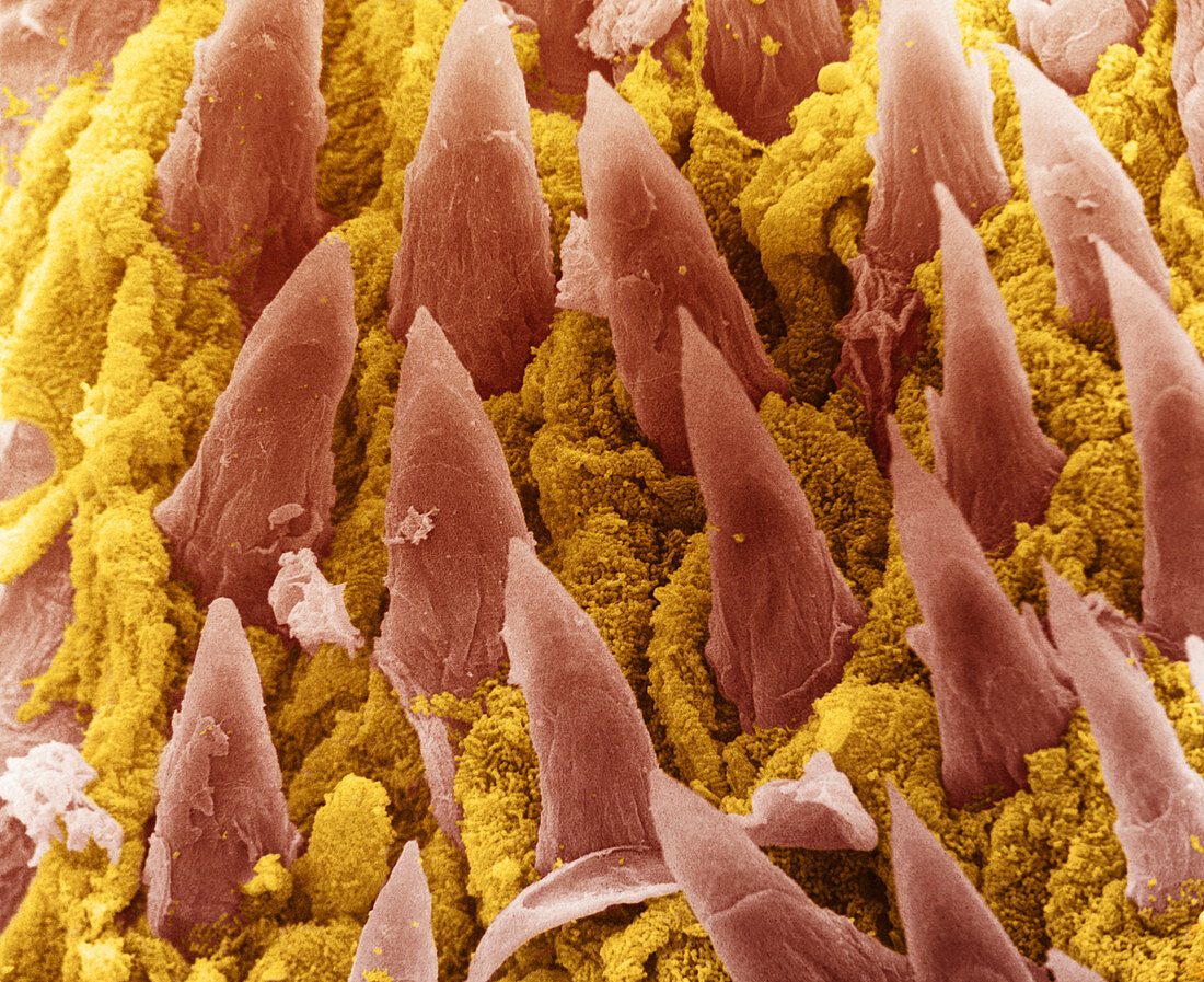 Bacteria on Rat Tongue,SEM