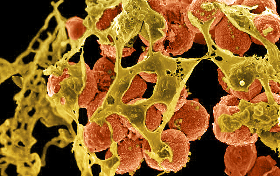 Staphylococcus aureus Bacteria,MRSA,SEM