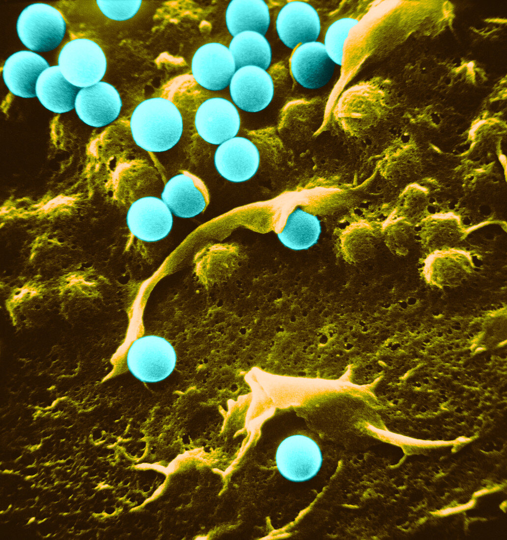 SEM of Macrophage