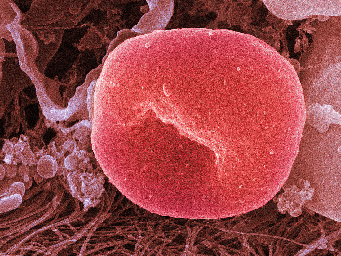 Human Red Blood Cell,SEM