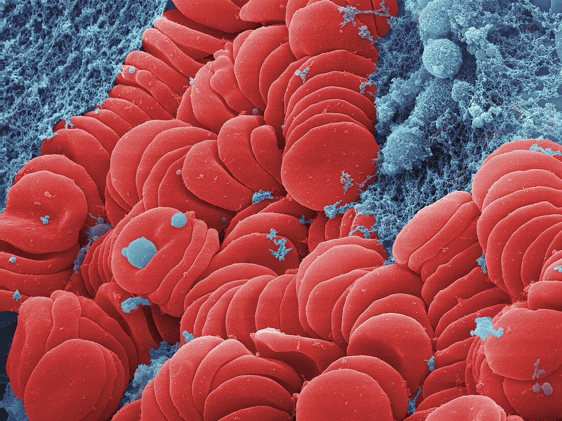 Human Red Blood Cells,SEM