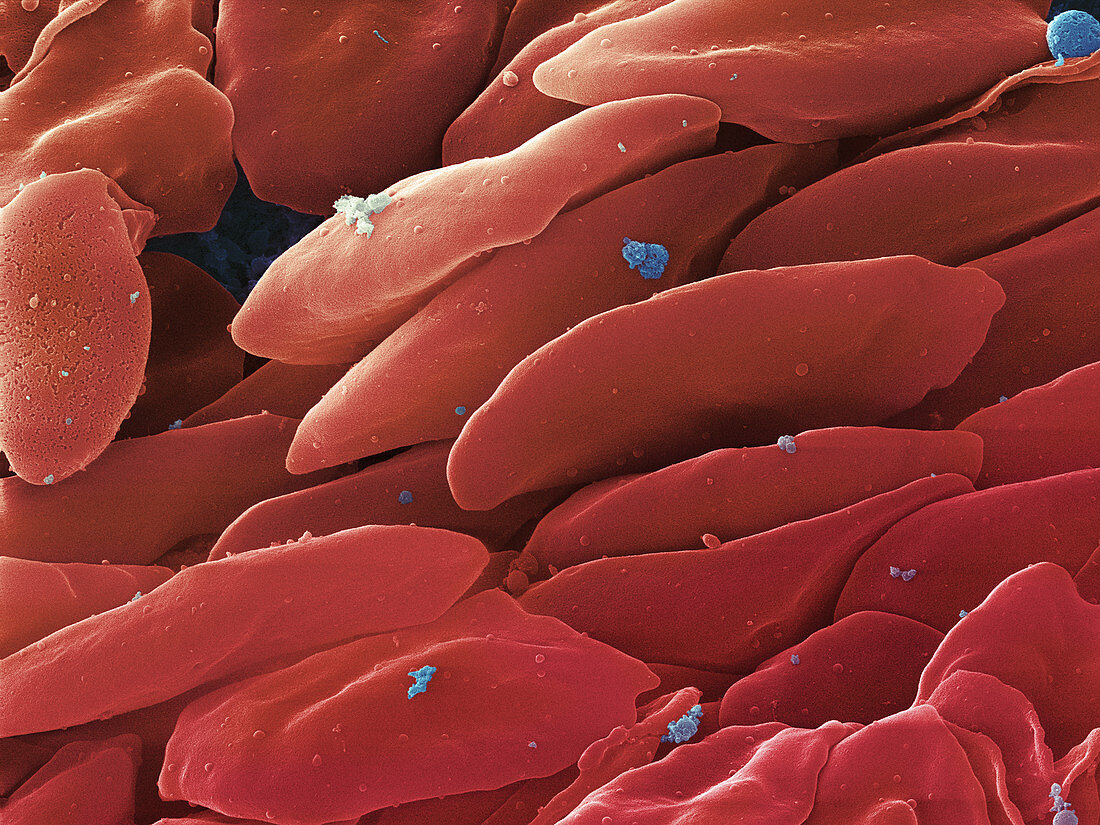 Blood Platelets,SEM