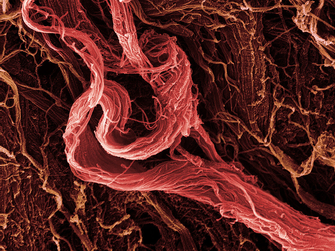 SEM Human Muscle Tissue
