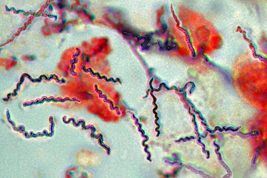 Borrelia Bacteria,LM