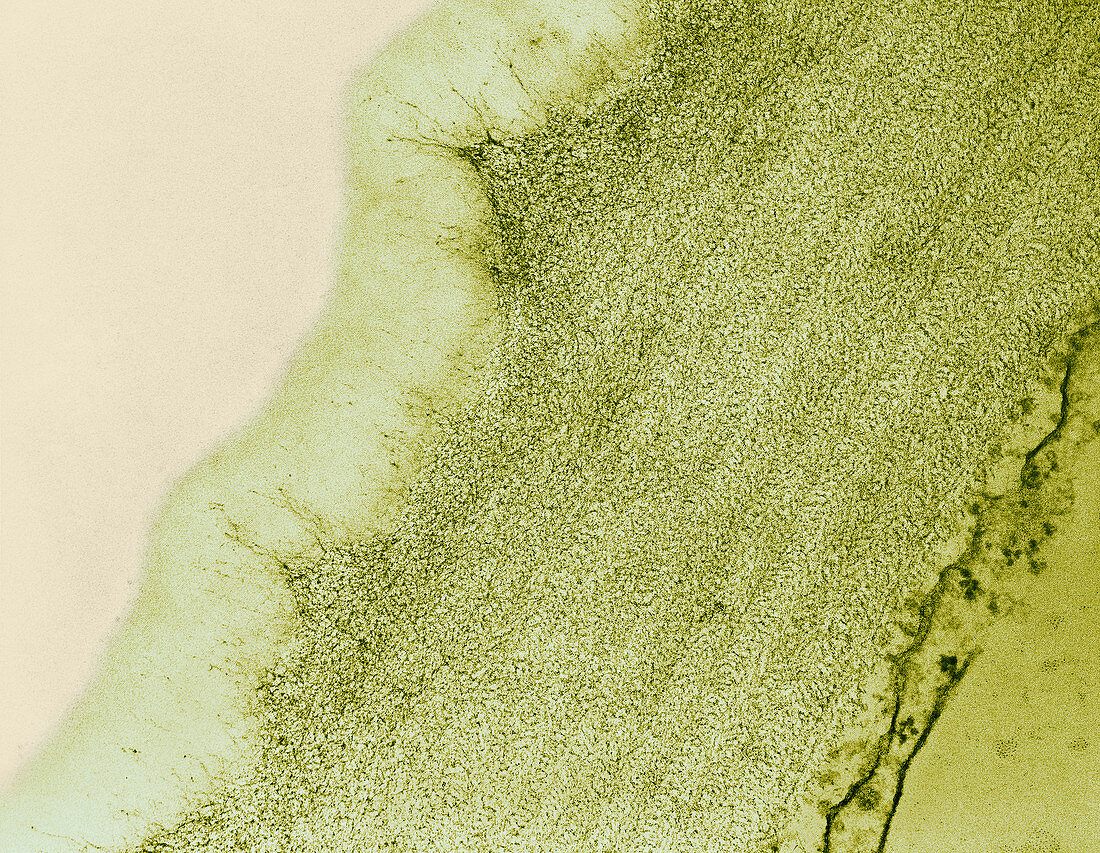 Celery,Cuticle of Epidermal Cell,TEM