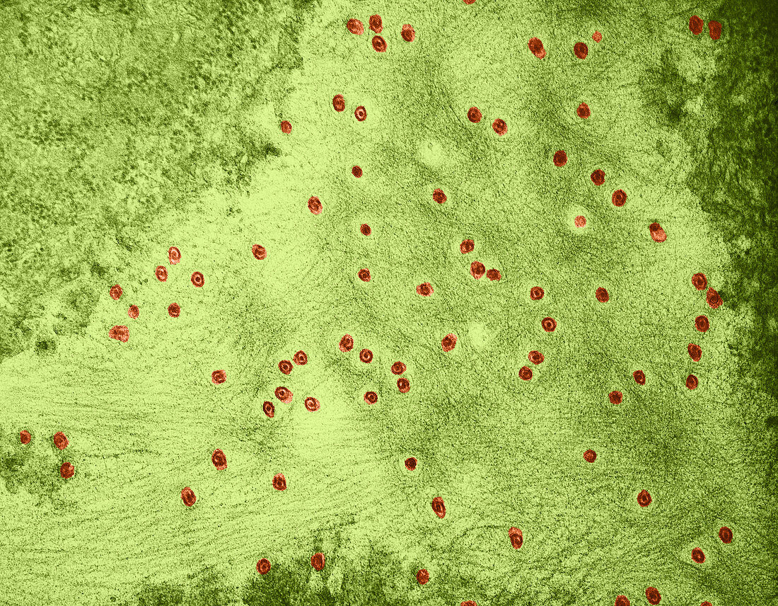 Plasmodesmata in Wheat,TEM