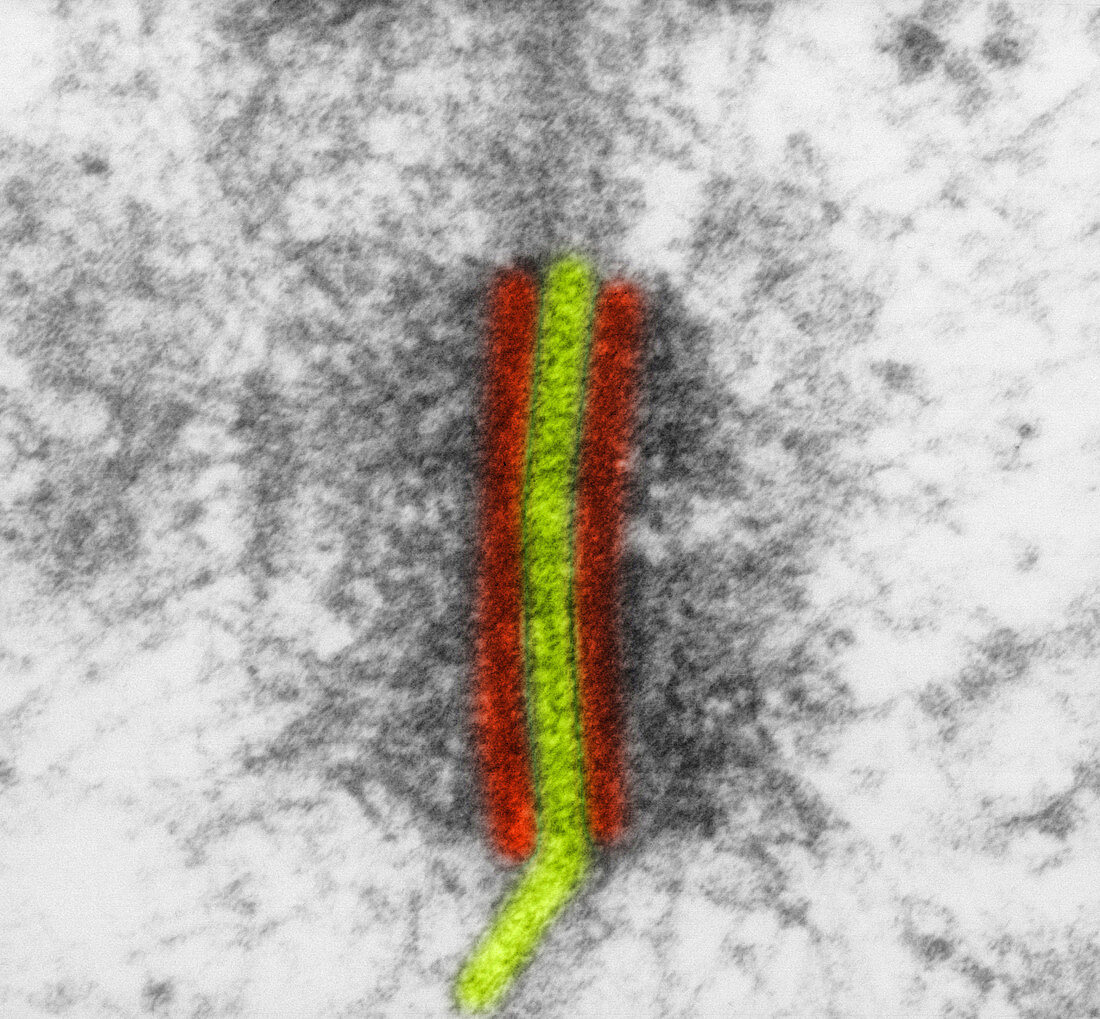 Desmosome with Adhesion Plaques,TEM