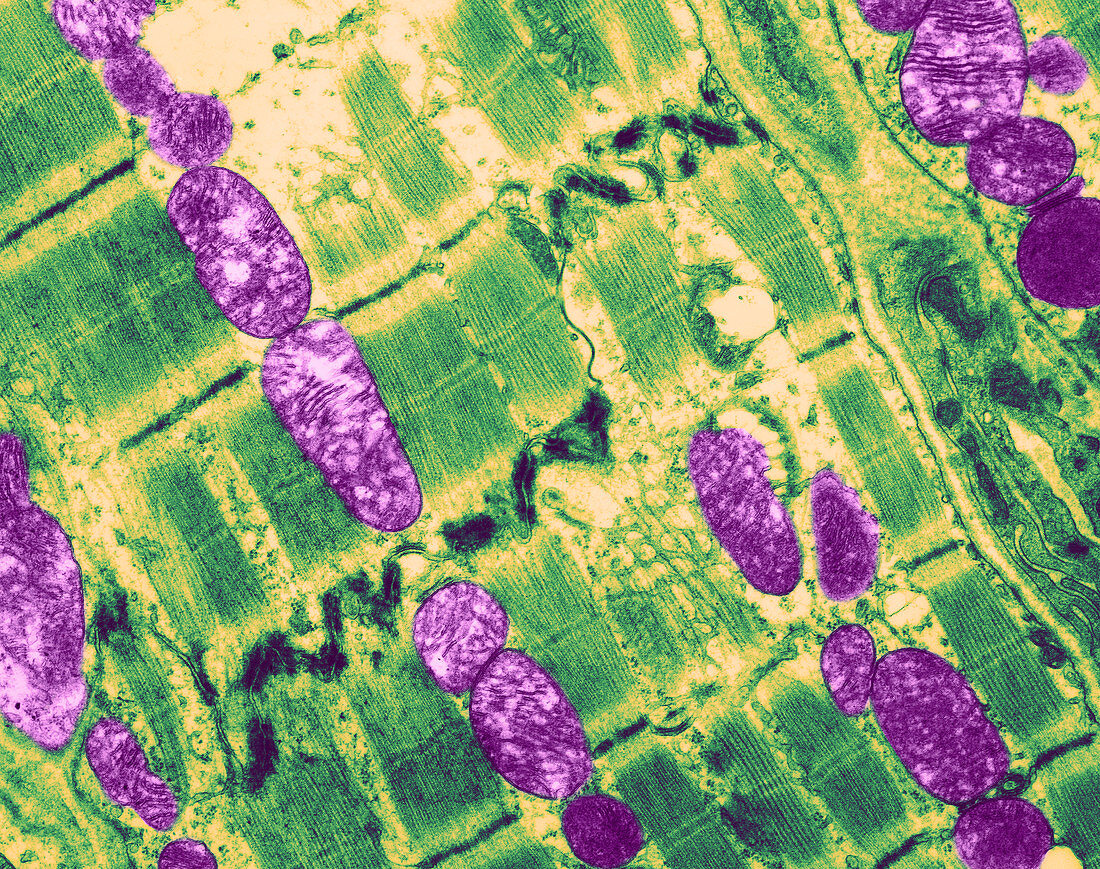 Cardiac Muscle,Sarcomeres,Mitochondria