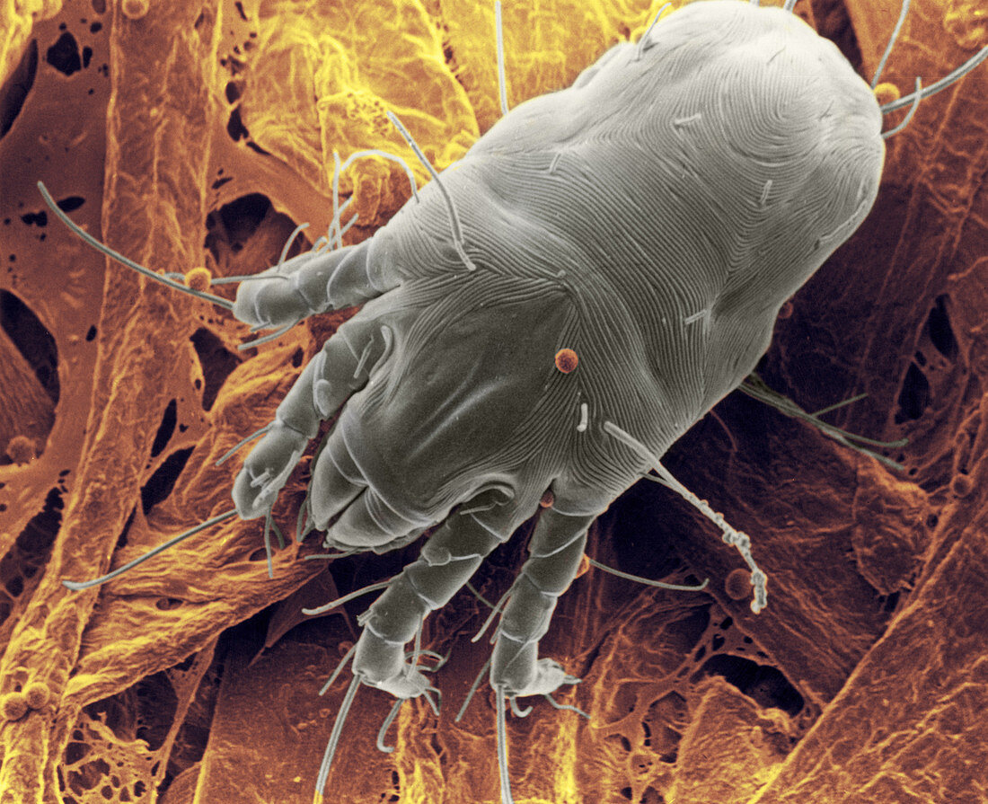 Dust Mite,SEM