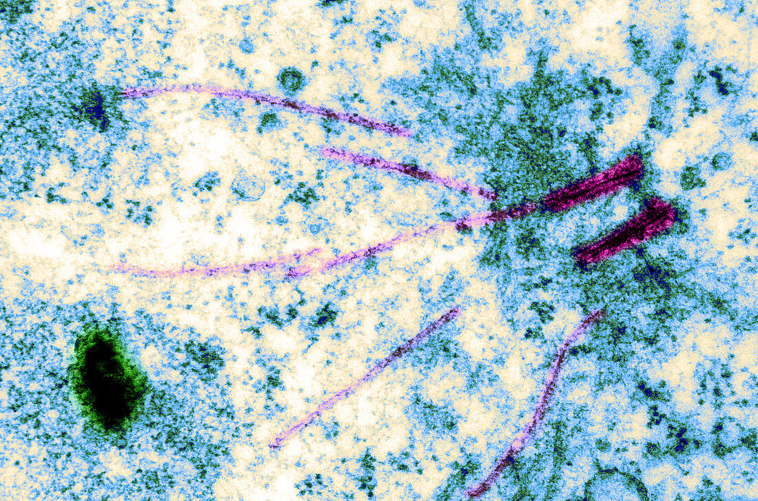 Centriole,Spindle Fibers,Chromosomes