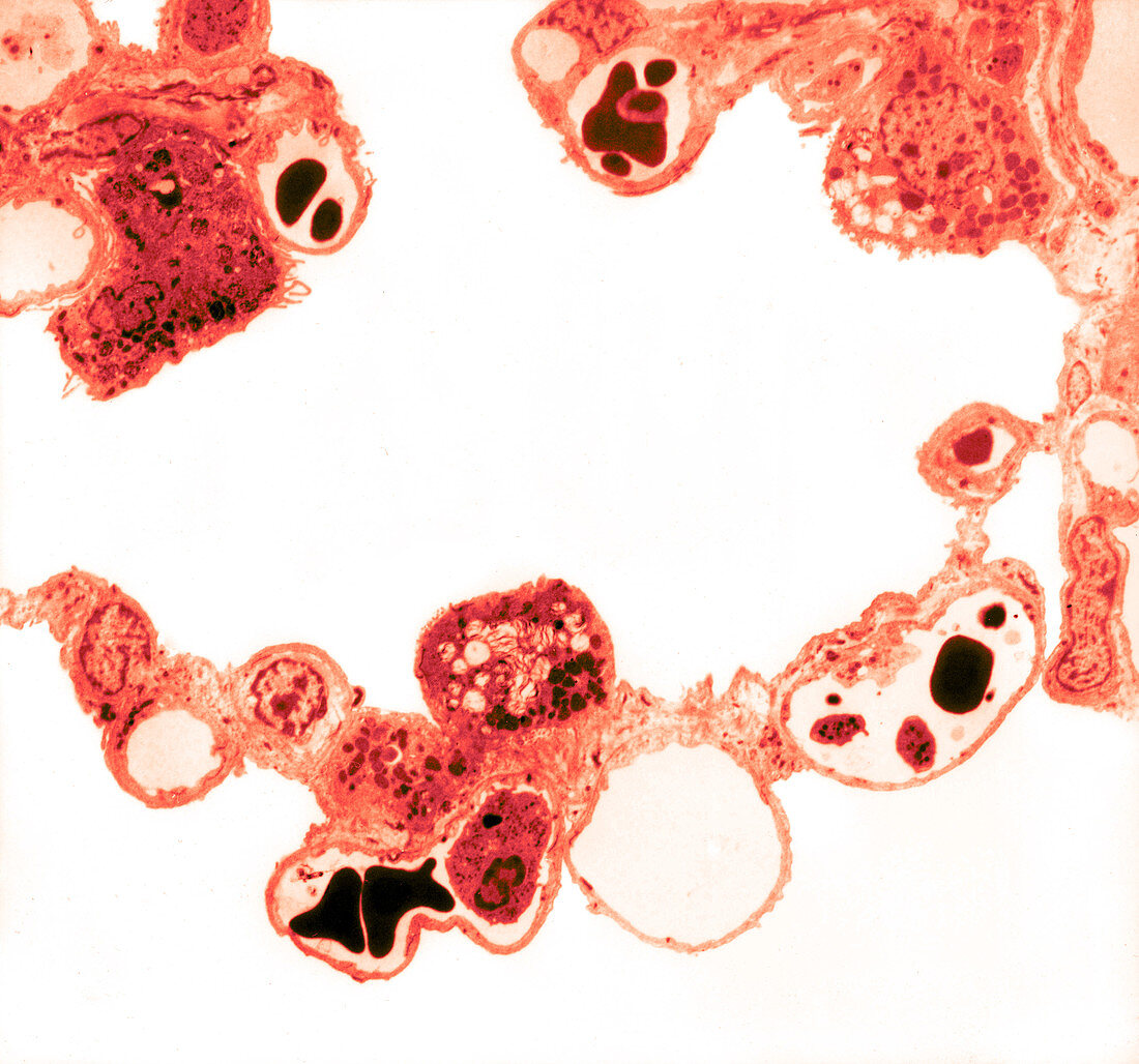 Alveoli Macrophages,LM