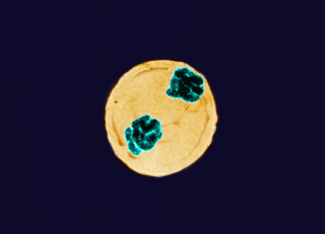 Anaphase of Mitosis in Trillium Cell