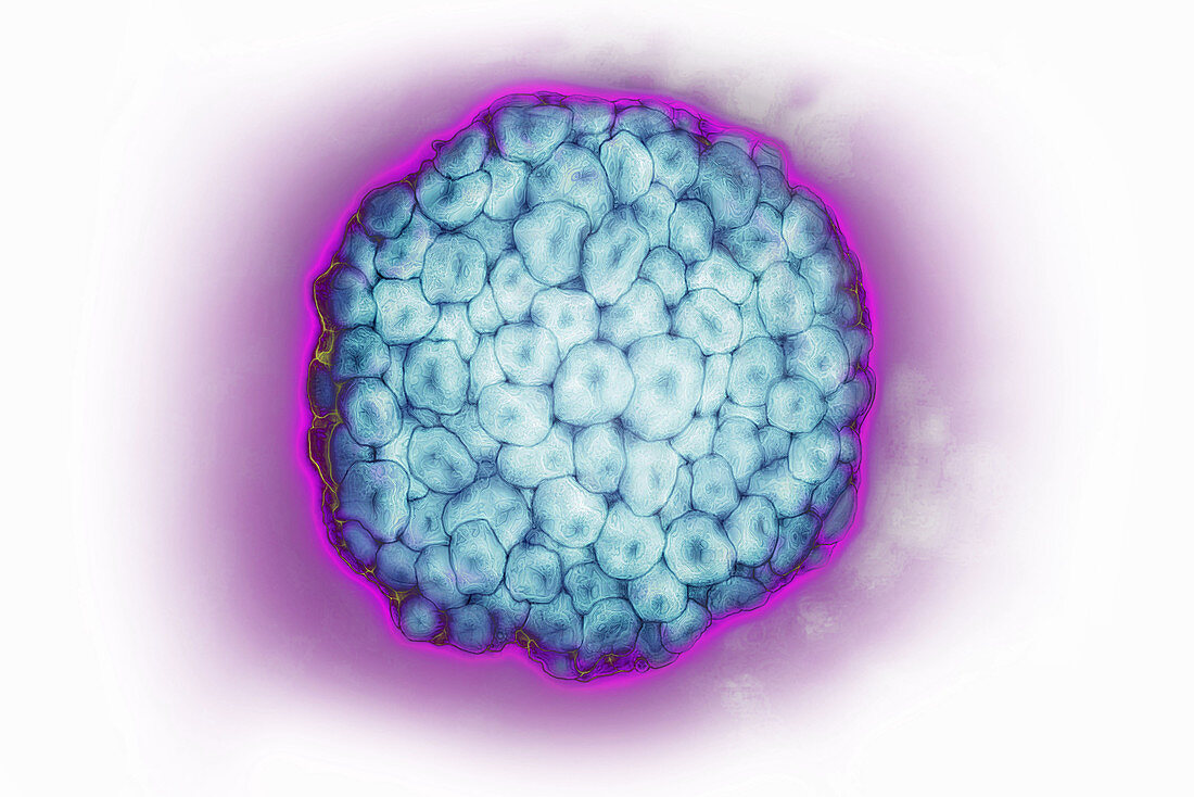 Human Papillomavirus,TEM