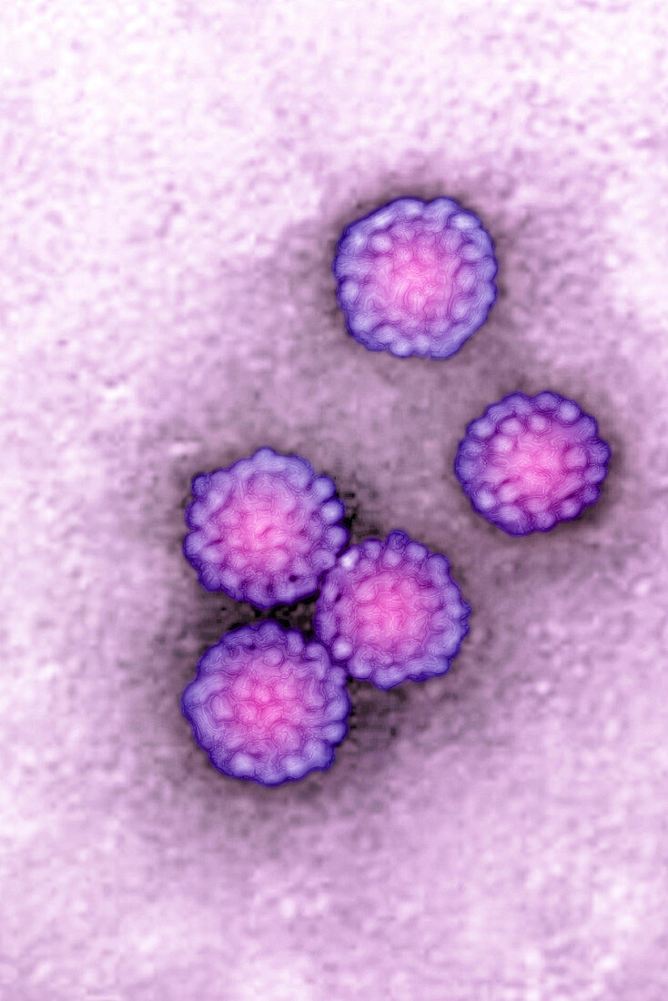 Human Papillomavirus,TEM