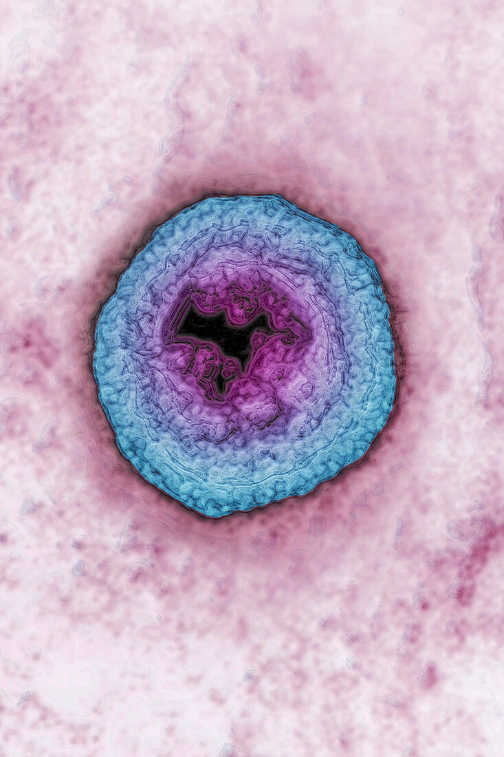 Varicella zoster virus,TEM