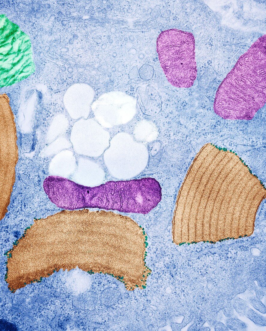 Alveolar cell,TEM