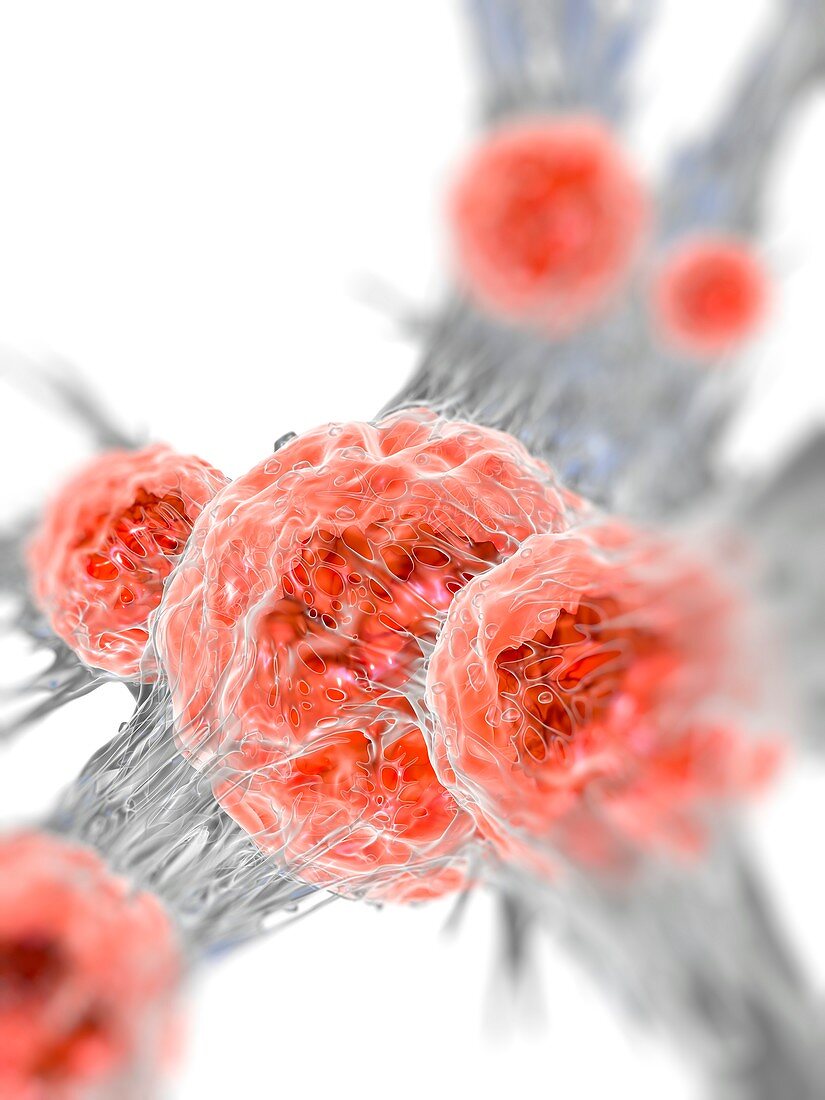 Cancer cell,illustration