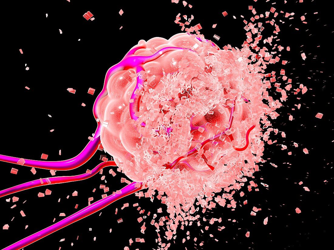 Tumour cell dissolving,artwork